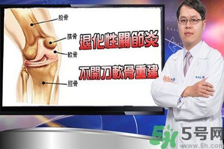 膝蓋痛怎么辦？膝蓋痛如何治療好？