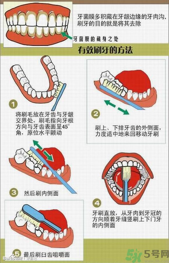 18歲還能戴牙套嗎？戴牙套真的能瘦臉改變臉型嗎？