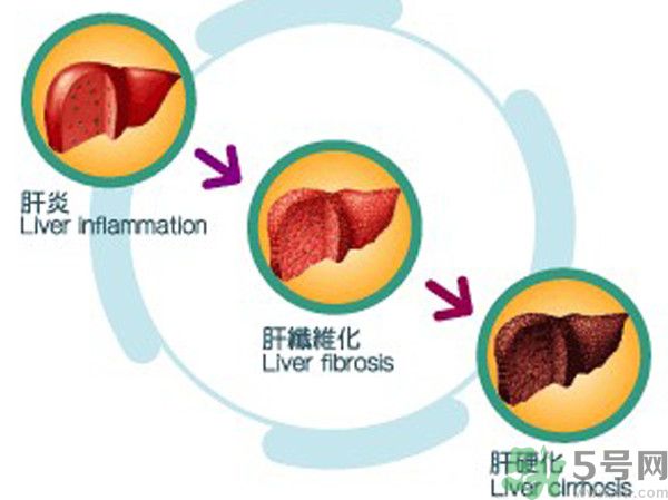 在外面吃飯會(huì)得乙肝嗎？在食堂吃飯會(huì)得乙肝嗎？