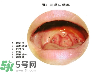 慢性咽炎的治療方法？慢性咽炎的藥物治療？