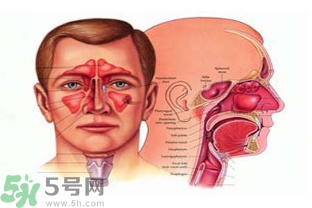 鼻竇炎是什么？鼻竇炎的癥狀有哪些？