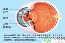 青光眼是什么？青光眼癥狀有什么？