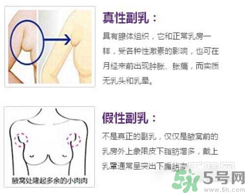 副乳是什么？副乳的危害