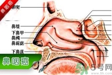 鼻咽癌是什么？鼻咽癌的癥狀有哪些？