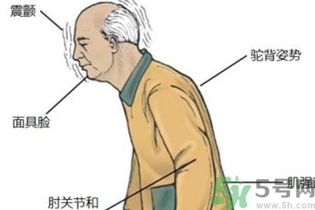 帕金森的易發(fā)人群有哪些？如何預(yù)防帕金森？