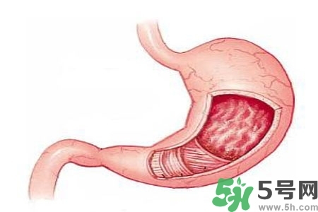 急性腸胃炎哪些食物不可以吃？急性腸胃炎不能吃的水果有？