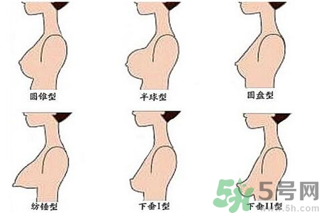 ?女性乳房下垂的原因是什么？女性乳房下垂的分類有哪些？