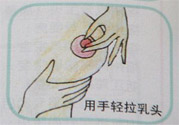 乳頭內(nèi)陷怎么回事？乳頭內(nèi)陷的原因是什么？