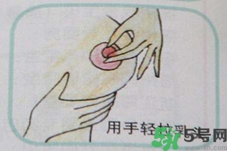 乳頭內(nèi)陷怎么矯正？乳頭內(nèi)陷矯正方法是什么？