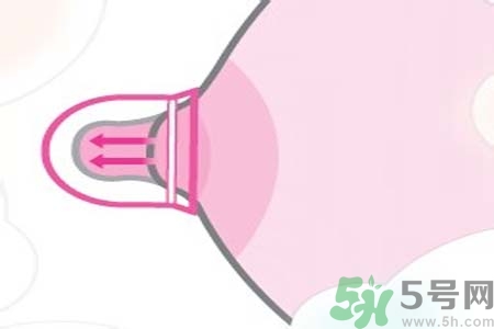 乳頭內(nèi)陷能不能喂奶？乳頭凹陷怎樣哺乳？