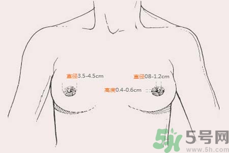 乳頭內(nèi)陷能不能喂奶？乳頭凹陷怎樣哺乳？