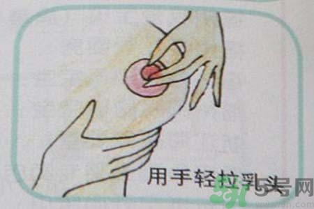 乳頭內(nèi)陷可以拔罐嗎？乳頭內(nèi)陷需要手術(shù)治療嗎？