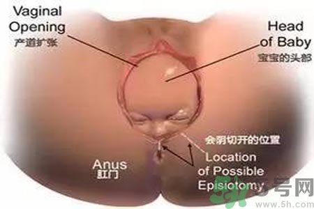 女性陰道松弛的原因是什么？女性陰道松弛怎么辦？