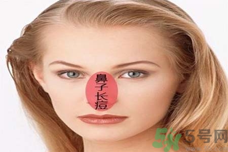 鼻翼長(zhǎng)痘痘怎么回事？鼻翼長(zhǎng)痘痘的原因是什么？