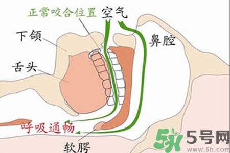 鼻子紅是什么原因？鼻子紅怎么辦？