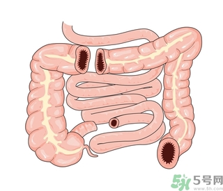 腸炎肚子疼怎么辦？腸炎肚子疼怎么緩解？