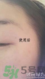 dr.jart適合什么年齡層？蒂佳婷適合年齡