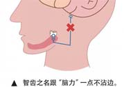 長智齒疼痛怎么辦？長智齒牙齦腫了怎么辦？