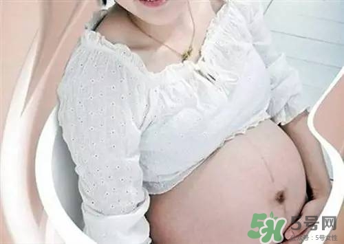 孕婦肚子上的黑線能看出生男生女嗎?