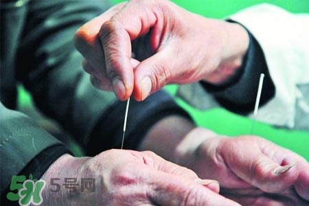 沒病可以針灸嗎？沒病可以扎針嗎？