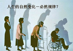 哪些人容易得骨質(zhì)疏松癥？骨質(zhì)疏松的高發(fā)人群有哪些？