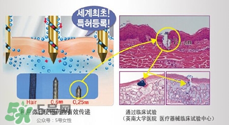 珠兒麗蚊子針好用嗎？珠兒麗蚊子針副作用