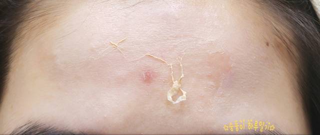 real skin patch怎么樣？real skin是什么牌子