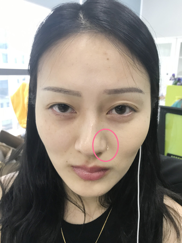 real skin patch怎么樣？real skin是什么牌子