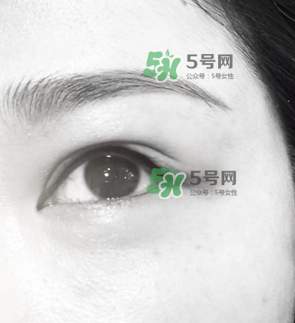 做美瞳線(xiàn)眼睛會(huì)腫嗎?做美瞳線(xiàn)眼睛腫了怎么辦?