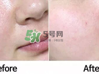 homefacialpro蜂膠面膜怎么樣_hfp蜂膠面膜好用嗎