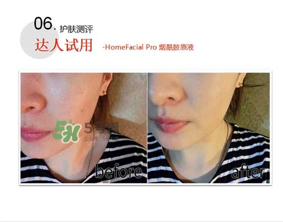 homefacialpro煙酰胺原液怎么樣？hfp煙酰胺原液好用嗎