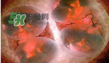 多胞胎是怎么生產(chǎn)的？多胞胎應(yīng)選擇什么分娩方式