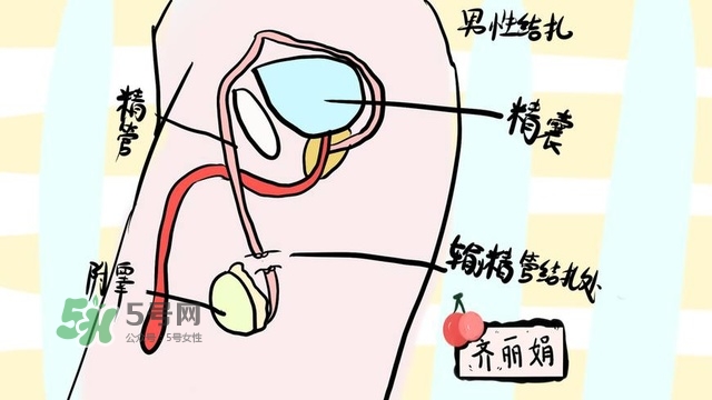 生完二胎一定要結扎嗎？生完二胎結扎好不好？