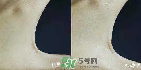 小黑瓶和小棕瓶可以一起用嗎？小棕瓶和小黑瓶哪個(gè)先用