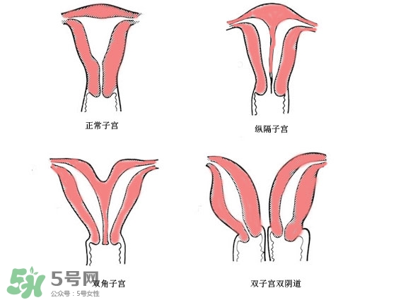 雙子宮是什么意思？雙子宮可以順產(chǎn)嗎？