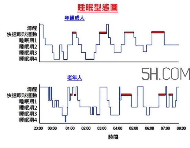 睡眠不足會促使大腦功能衰退嗎?