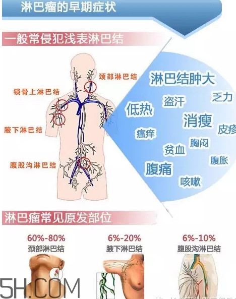 淋巴癌是怎么回事？淋巴癌如何診斷