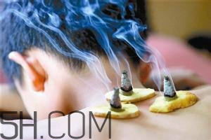 艾灸對(duì)慢性咽炎有用嗎？慢性咽炎可以通過艾灸來治療嗎？