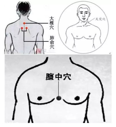 吮痧有什么療效？最溫柔的治病方法