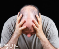 脫發(fā)有沒有治？只要不是禿子就有得治