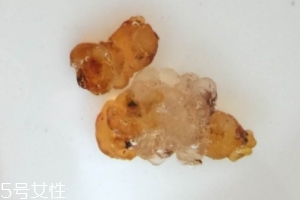 桃膠可以用開水泡嗎？用開水泡桃膠好嗎？