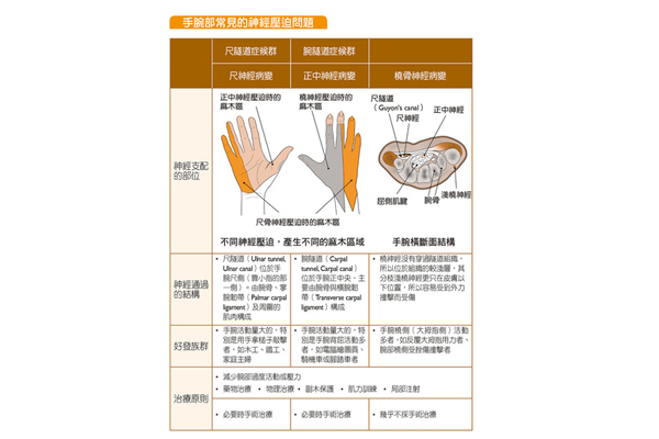 手麻每天4動作 解決神經(jīng)壓迫