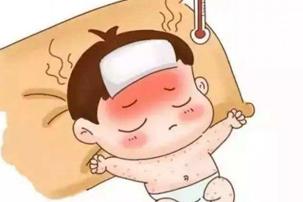 幼兒急疹和麻疹區(qū)別 3步看出寶寶是否是麻疹