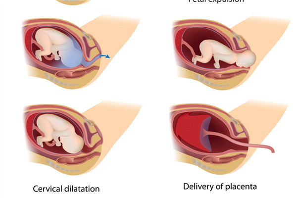 分娩過(guò)程的順序 全程疼痛劇烈