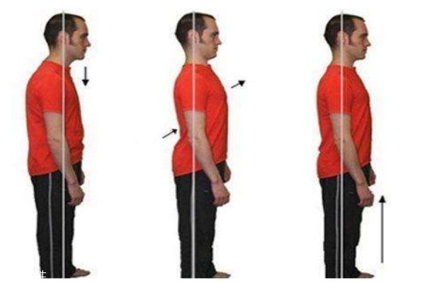 骨盆前傾的癥狀 骨盆前傾的自測(cè)辦法