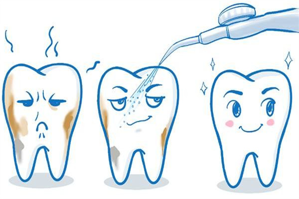 為什么洗牙有異物感 洗牙的誤區(qū)