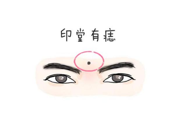 點(diǎn)痣是什么意思 點(diǎn)痣后要做好保護(hù)措施