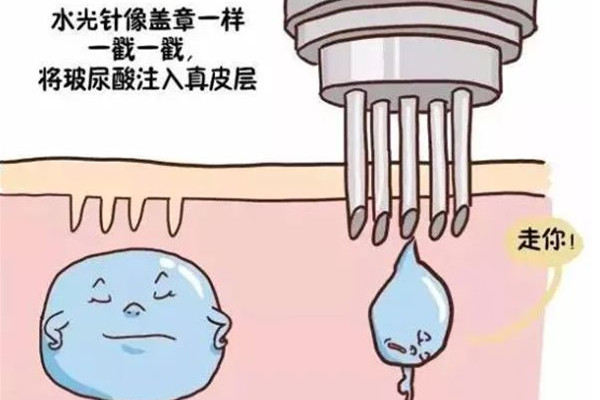 水光針要打幾次才看得到效果 水光針幾針一個療程