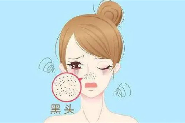 后湖skin79皮膚管理中心去黑頭干凈嗎 黑頭會(huì)自己排出來(lái)嗎